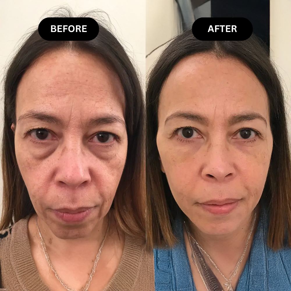 BrightLift 3-in-1 Eye Repair Concealer